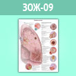 Плакат «Болезни легких» (ЗОЖ-09, ламинир. бумага, A1, 1 лист)
